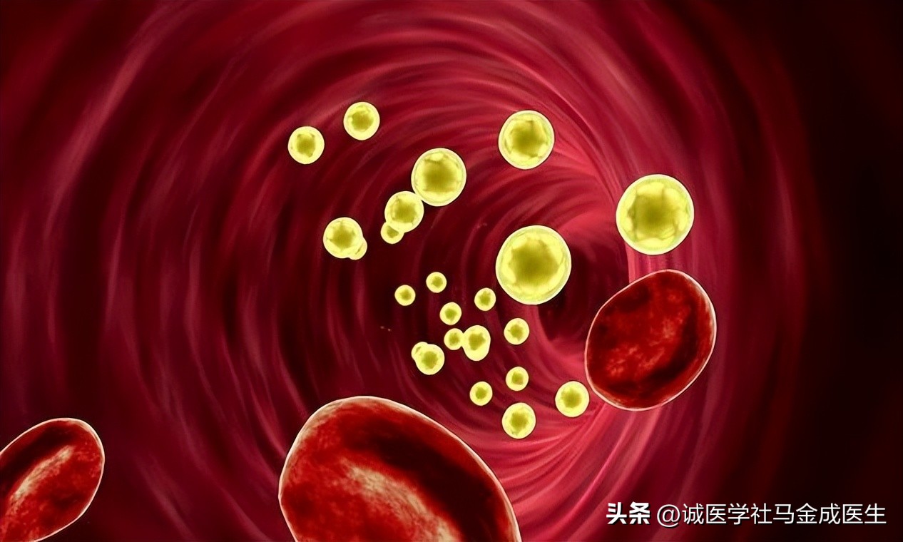 每天喝一点酒助眠对身体好吗,喝酒能助眠还是加重失眠