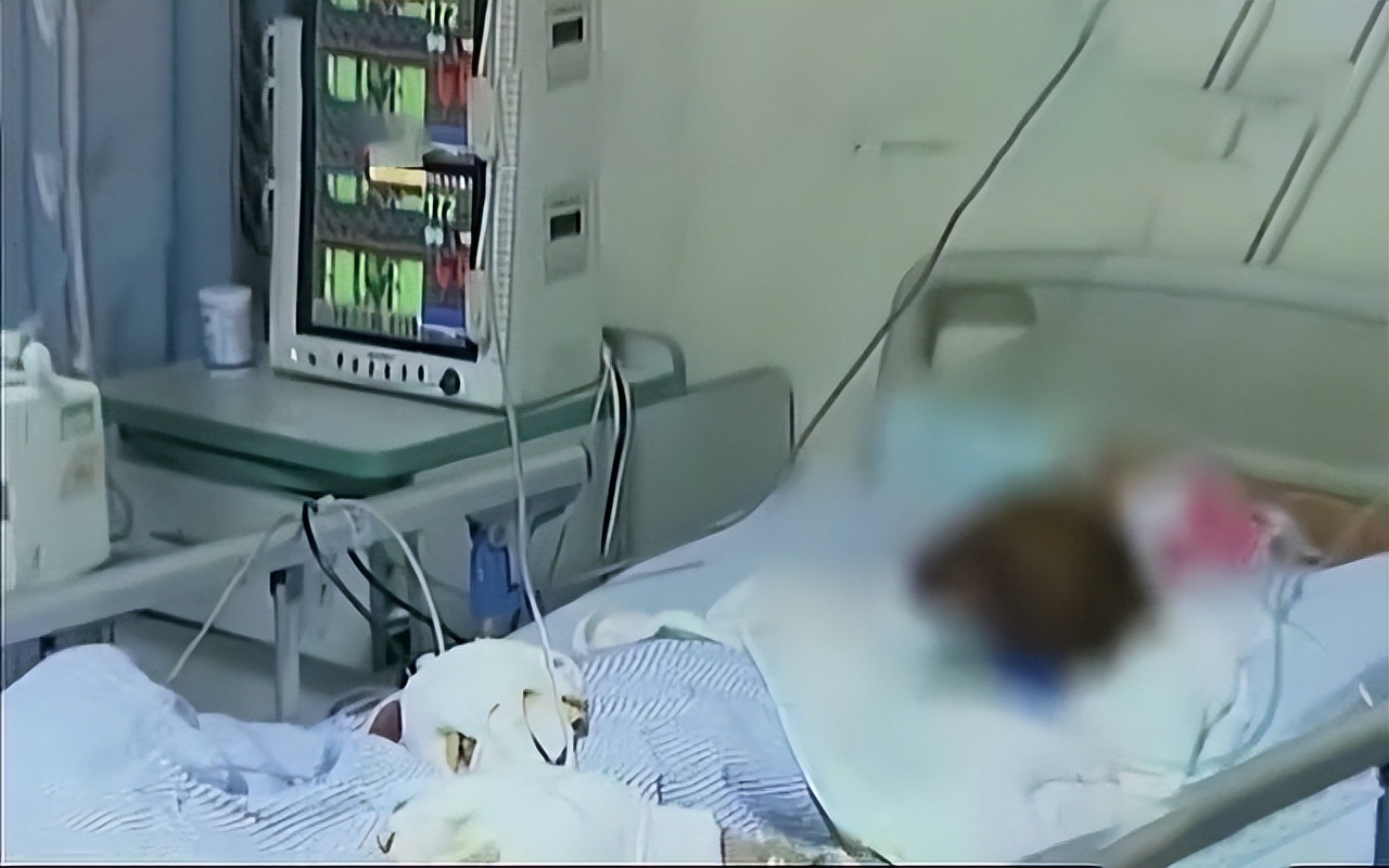 女子因为火灾毁容,女子因火灾而毁容