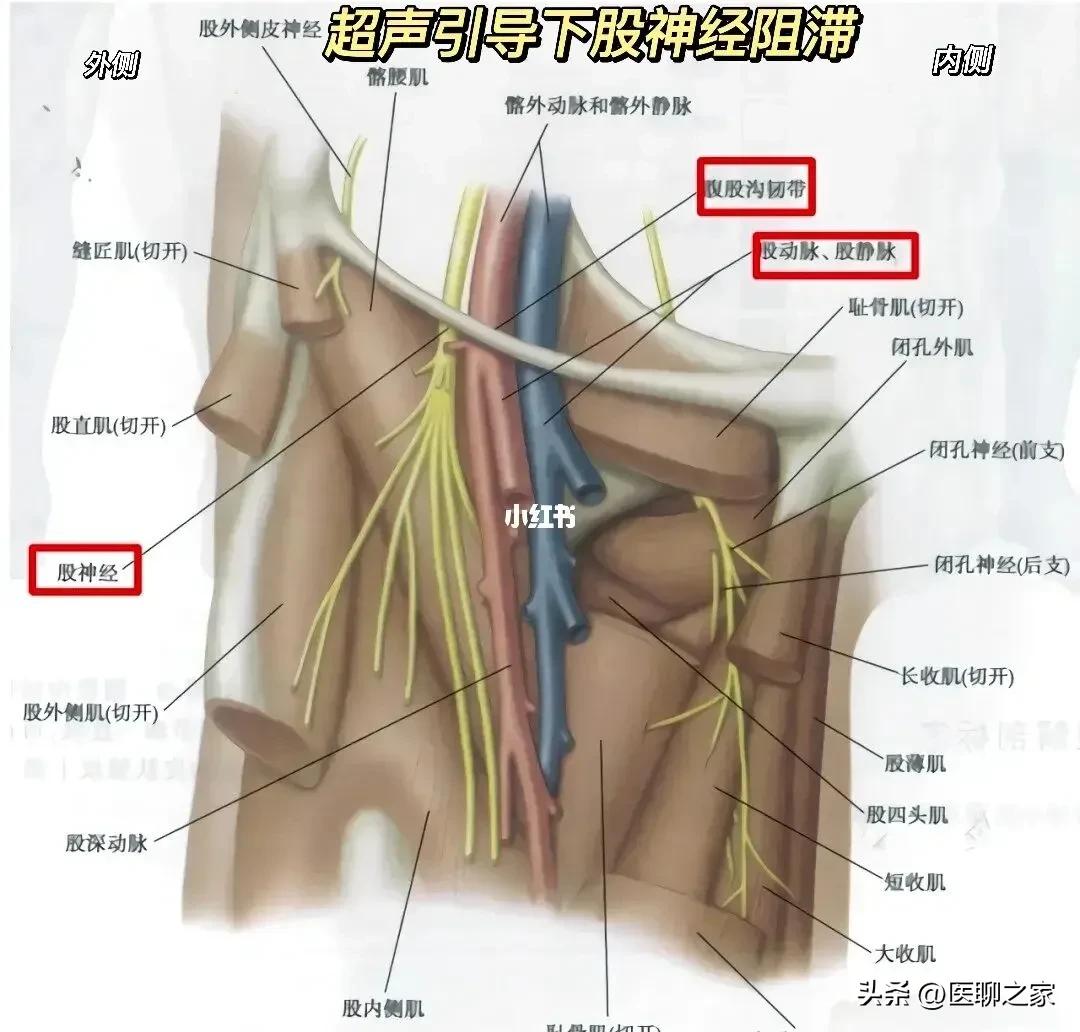 超声引导下髂筋膜神经阻滞视频,超声神经阻滞治疗疼痛