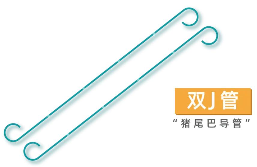 双j型导管术后如何护理,手术后导管固定方法