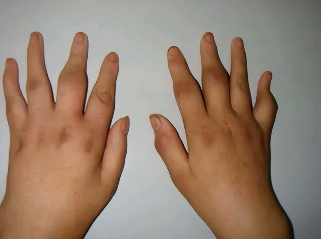 最新国际正常心率范围,心跳多少次算正常范围