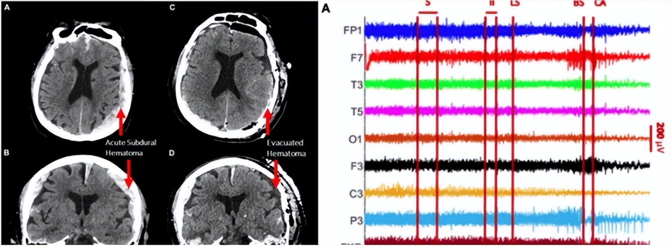 人死亡前会想什么,人去世时会想什么