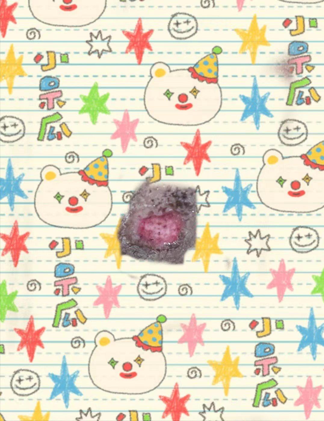 美容院激光治疗维权,激光脱毛投诉