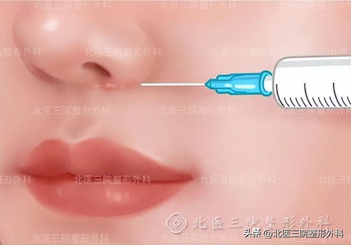 唇部术后修复注意事项及处理方法,唇部瘢痕是最难治疗的吗