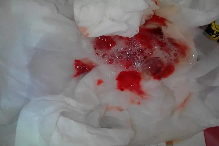 胃出血能活多久,胃出血吃什么药有效