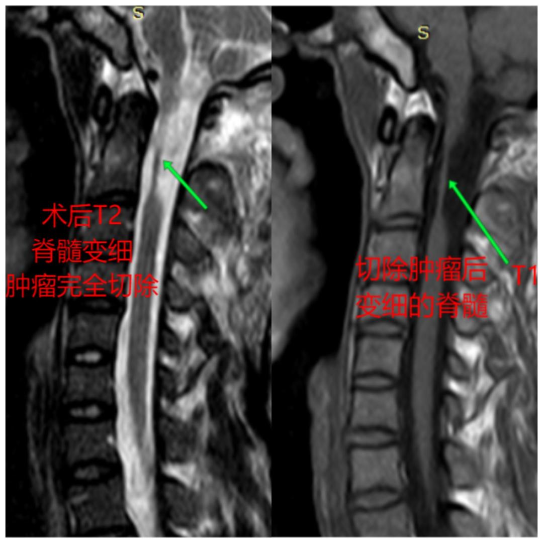 昭通第一人民医院神经外科在几楼,昭通第一人民医院开颅手术怎么样