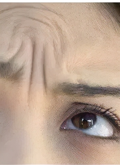 奖门人提醒：别叫“纹”题成问题，皮肤科医生教您抵抗岁月痕迹