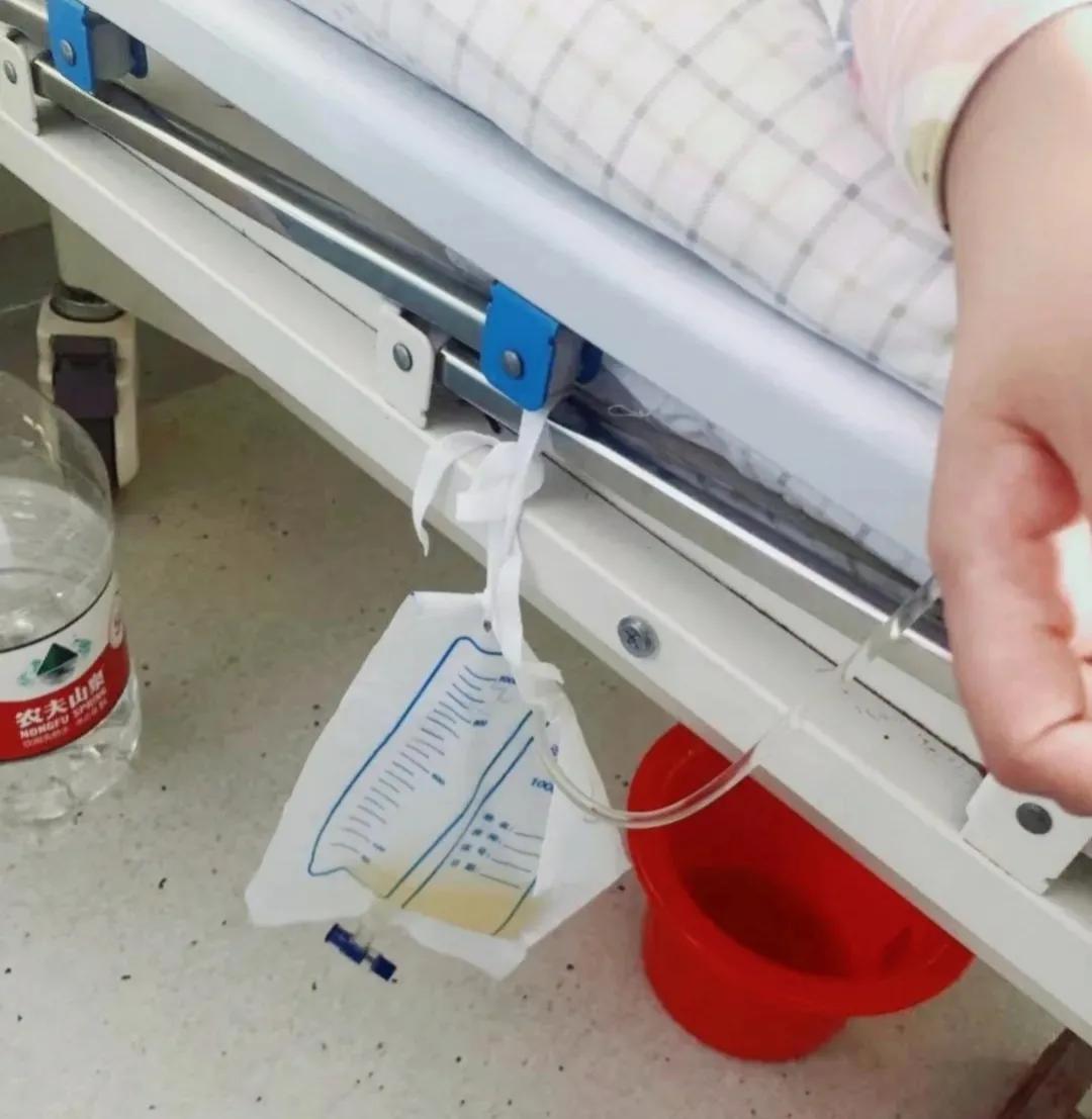 子宫肌瘤开腹手术后要卧床多久,子宫肌瘤开腹手术后敷料贴多久