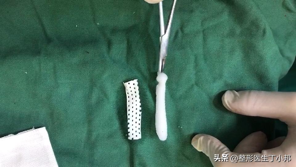 假体隆鼻发红怎么修复,假体隆鼻透光是怎么回事