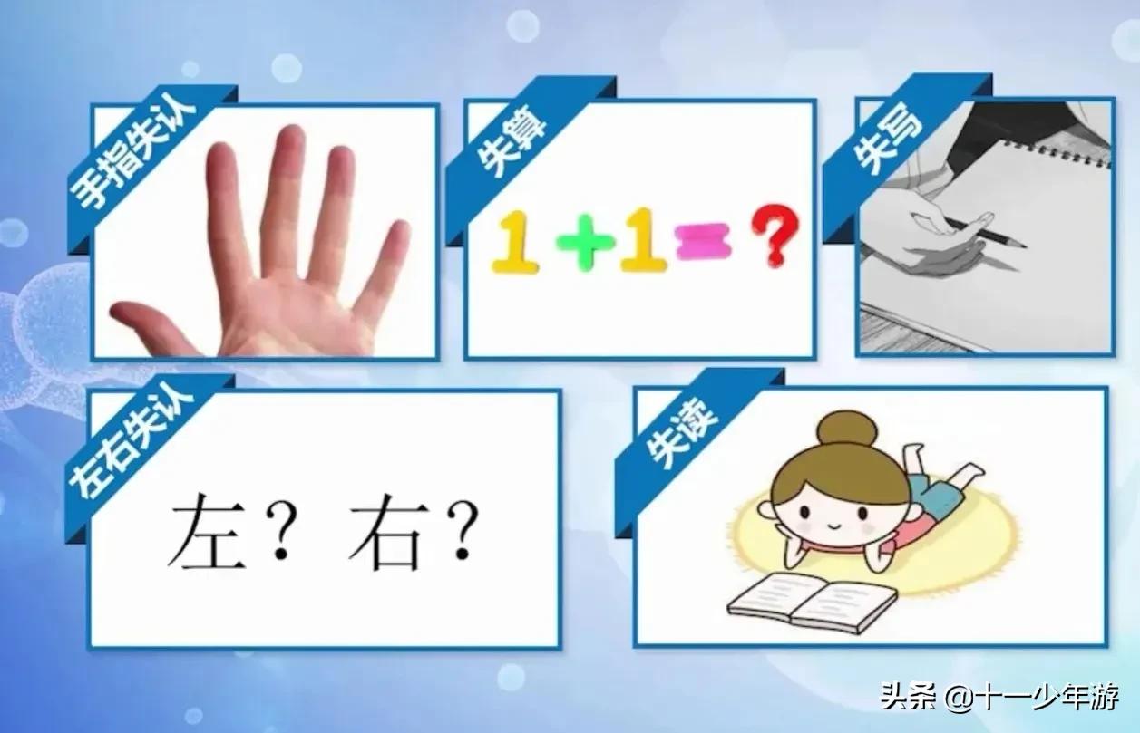 大脑的结构解剖示意图,大脑镰下疝解剖结构