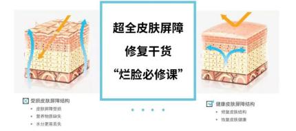 痘痘敏感肌脸起皮痒怎么办,油敏肌皮肤泛红刺痛时用什么