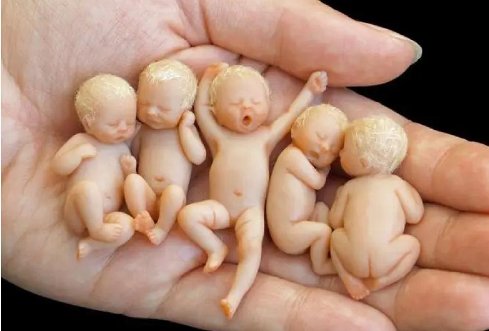 印度小伙意外怀孕,印度男子腹中神秘生物