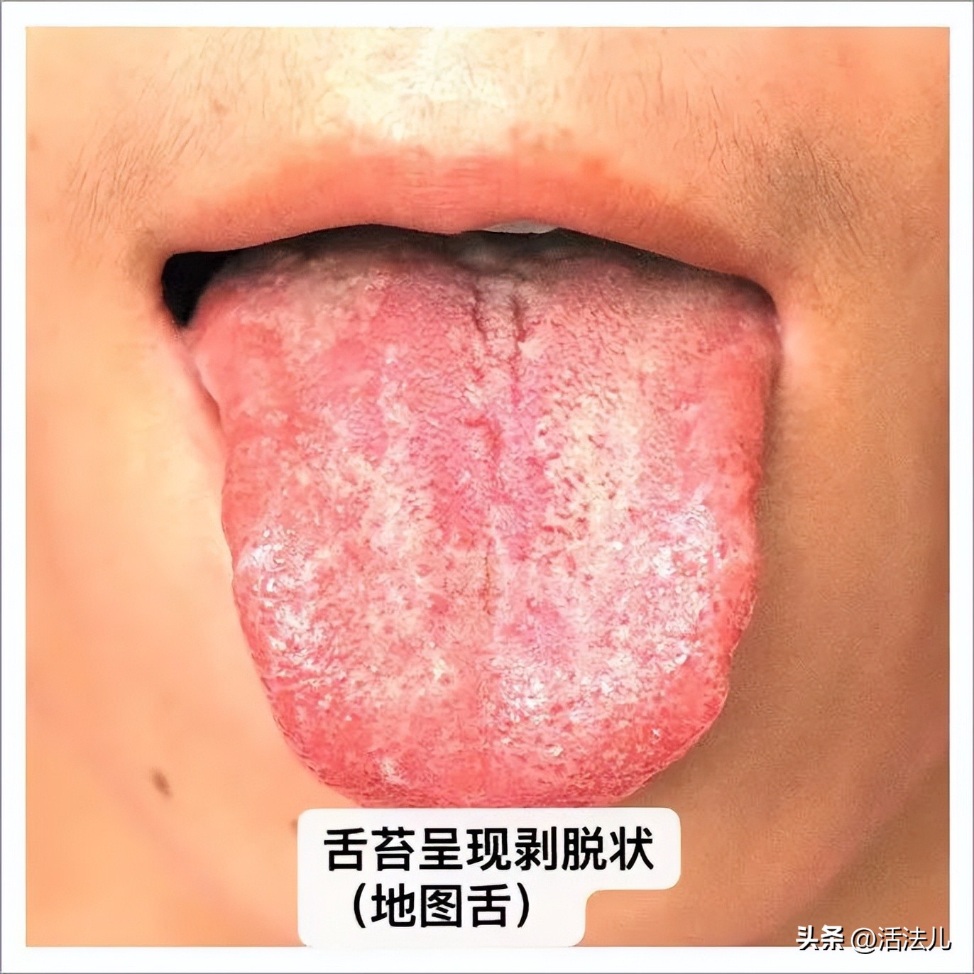 三伏天养生不动就出汗是不是祛湿,三伏天时浑身出汗怎么办