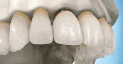 牙丑要怎么克服自卑,牙丑怎么变漂亮