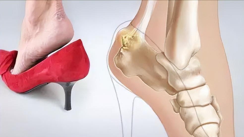 总是腰酸背痛？到底是什么原因？医生：睡前这样趴一趴或许管用！