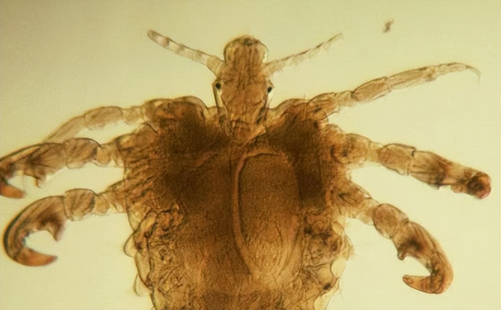 阴毛有什么用？越来越少了意味着啥？到底能不能刮？医生讲出实情