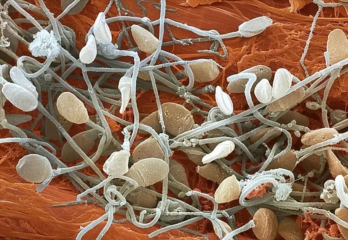 孩子会不会长得像前男友？那些没有成功的精子，最终去了哪里？