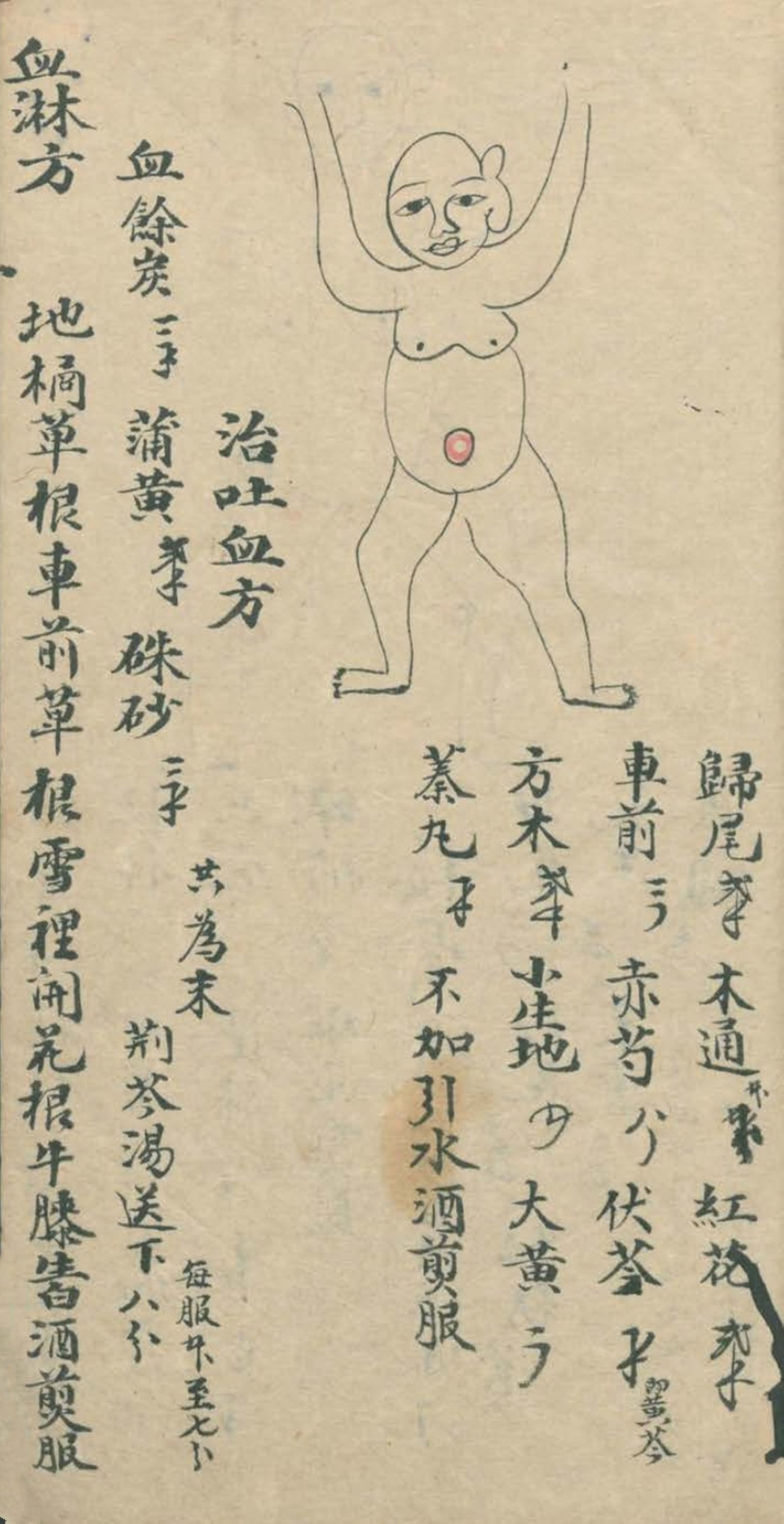 最实用的跌打药方,祖传跌打秘方100首