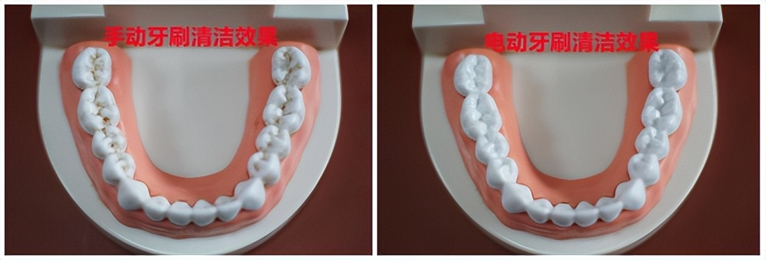 6岁儿童电动牙刷测评,儿童电动牙刷飞利浦和扉乐哪个好