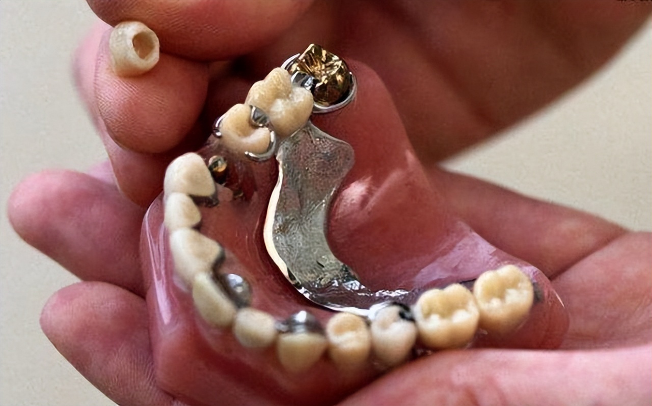 全口功能性义齿超级干货,全口义齿最好是哪种材料最舒服