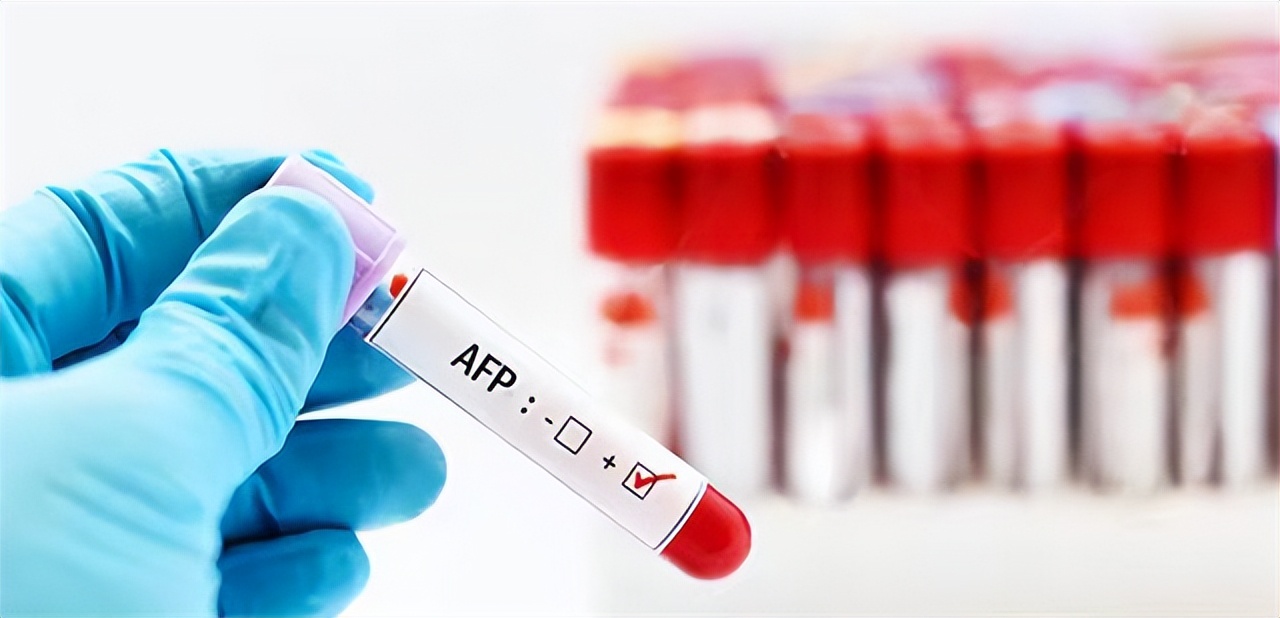 谷丙转氨酶高出多少是肝癌,谷丙转氨酶400谷草200会是肝癌吗