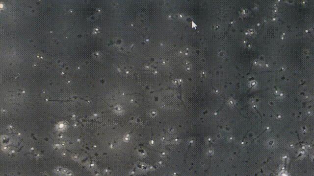 “一次，4500元！”全国各地求捐精，给谁用？真不会乱套吗？