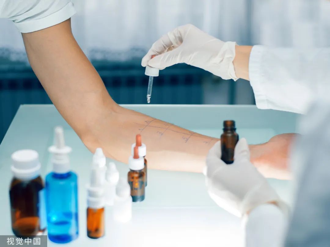 容易过敏是不是因为太干净了,为什么现在过敏的人越来越多