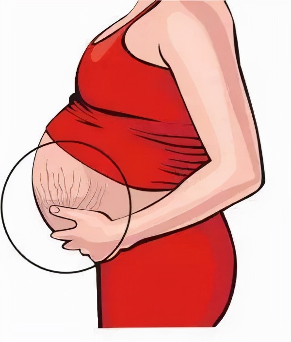 皮肤一道道纹路怎么回事,皮肤上的纹路到底怎么回事