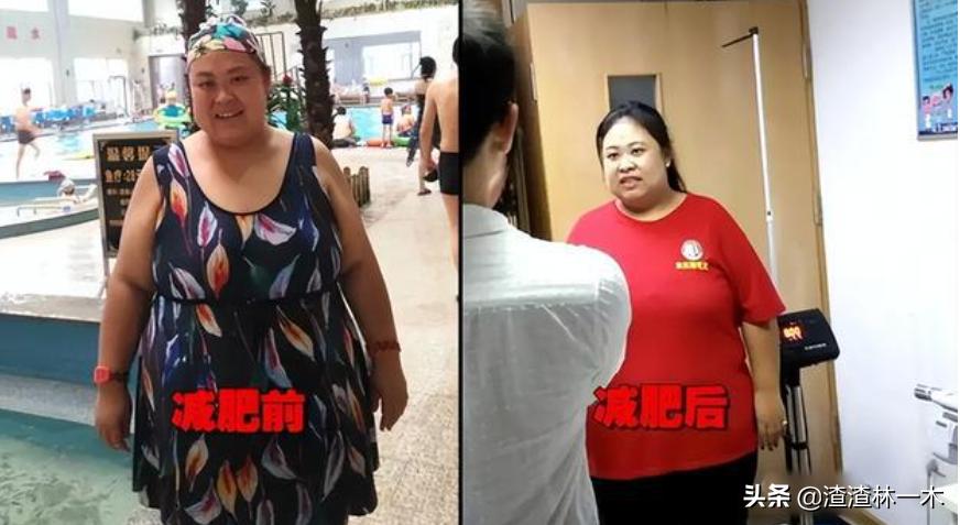 沈阳380斤孕妇,320斤孕妇把孩子生了吗