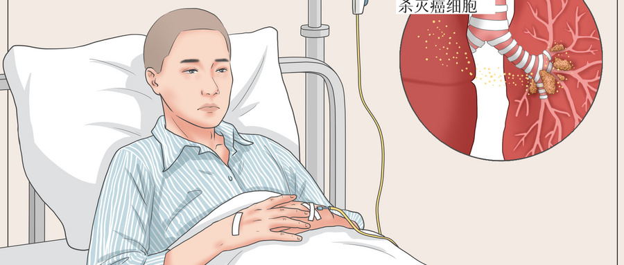 肿瘤患者化疗期间要注意什么,肿瘤化疗常见的不良反应及其处理