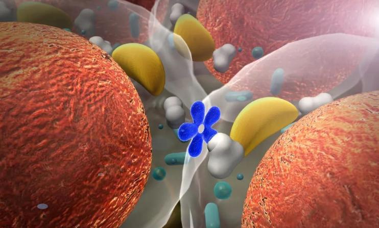 非酒精性脂肪肝的治疗,酒精性脂肪性肝病