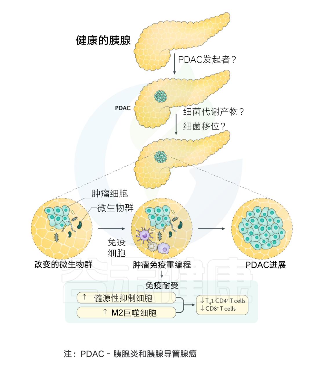 “隐藏高手”胰腺癌的新出路——微生物