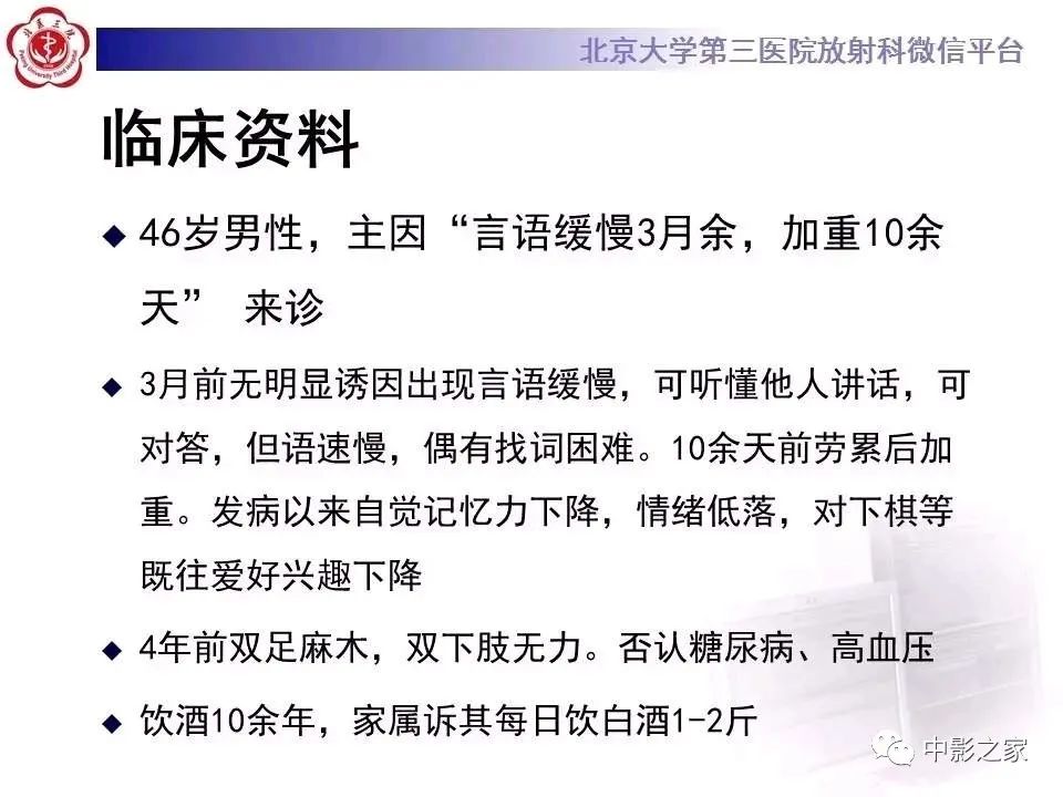 什么叫原发性胼胝体变性,原发性胼胝体变性治疗多少钱