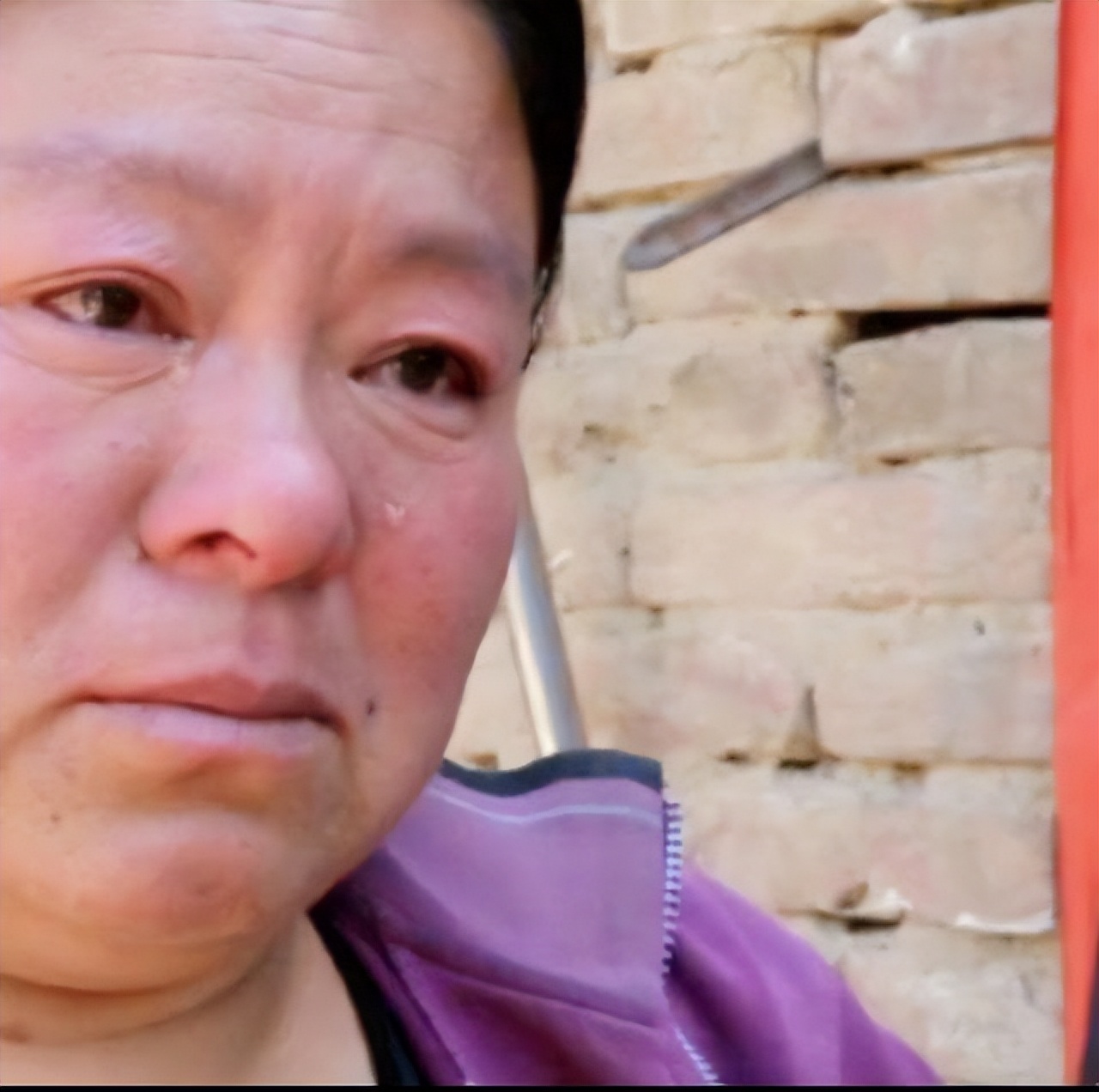 女童肚子超大疑似怀孕,2岁女婴肚中发现“胎儿”