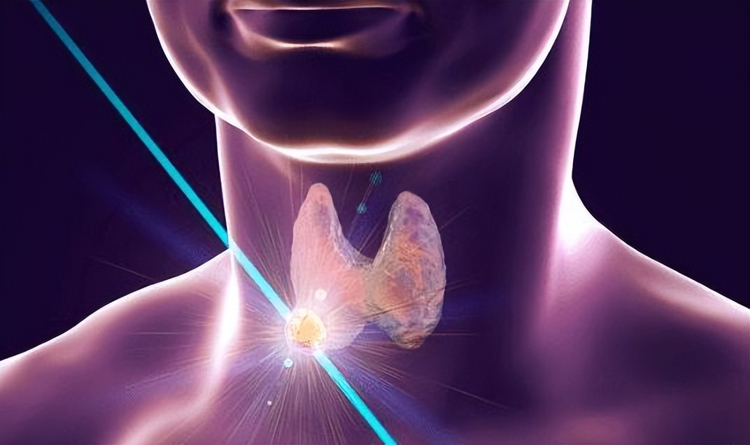 服用优甲乐不能喝奶粉吗,吃优甲乐不能喝牛奶吃鸡蛋吗