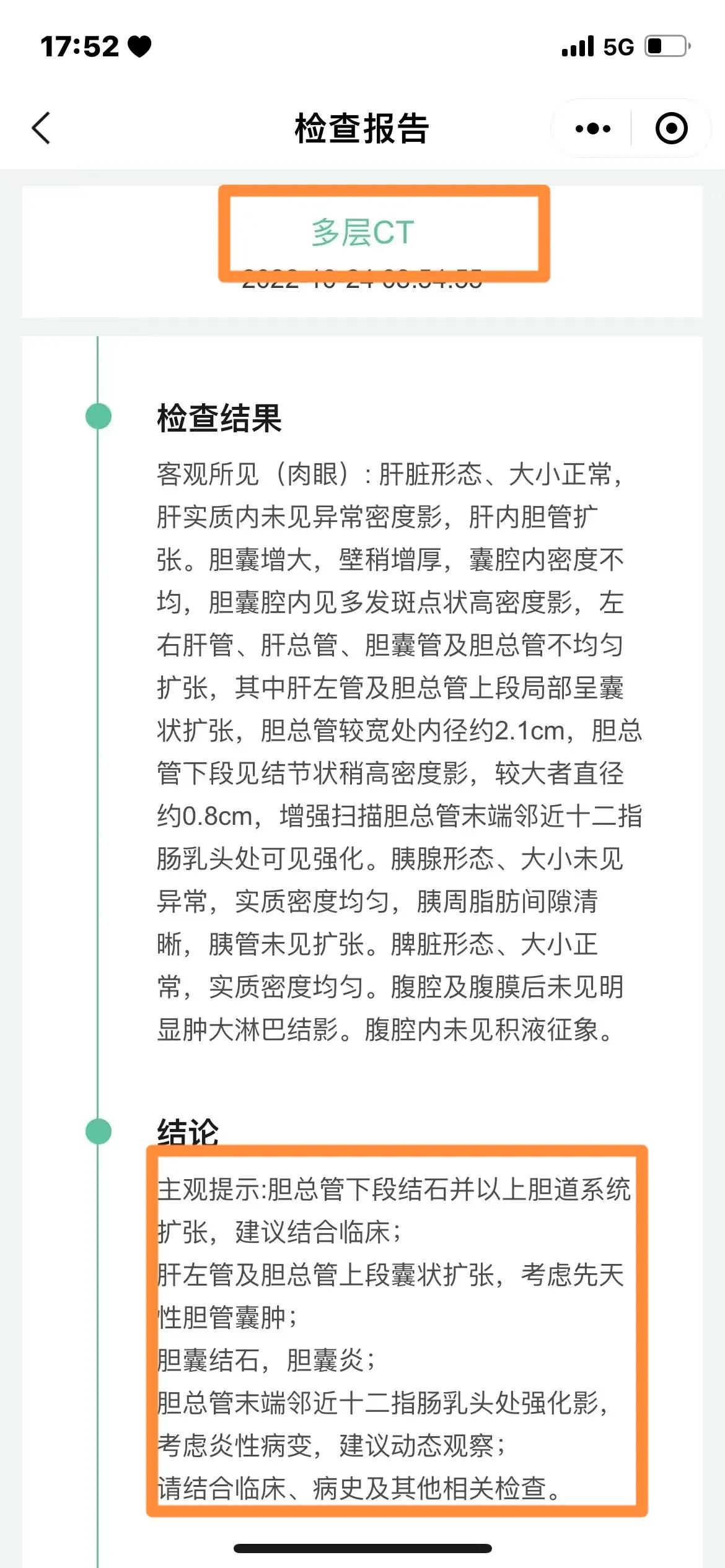 上火会导致尿液发黄吗,小便发黄是体内有火吗