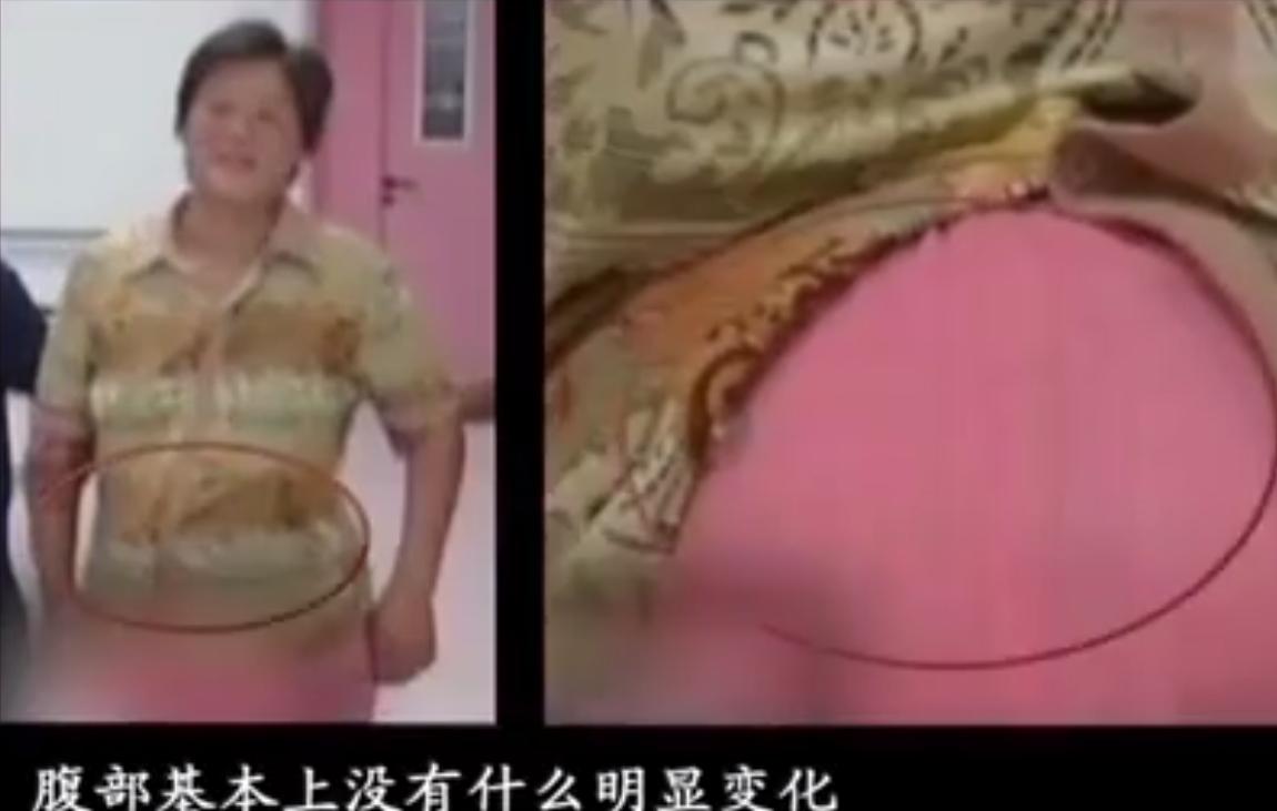 女子刚出月子又怀孕,女子醒来发现肚子里孩子没了