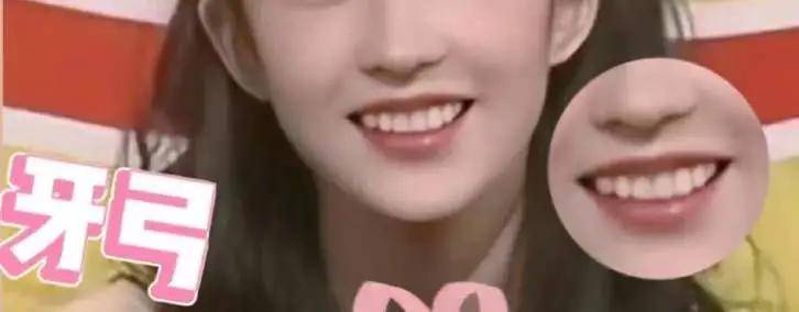 国民初恋毁容了,国民初恋盛世美颜