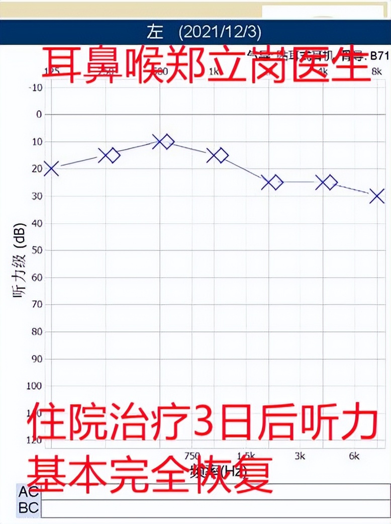 突然耳聋堵塞是怎么回事,耳朵痒听力下降有堵塞感