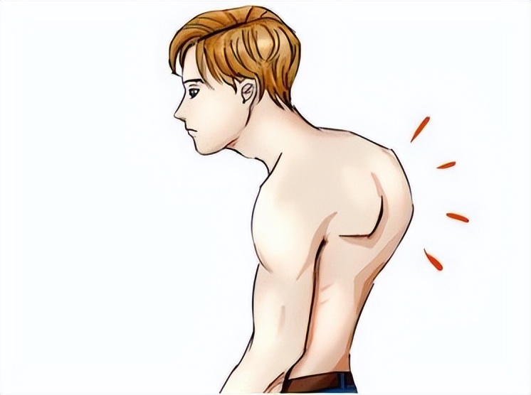 驼背怎么办，驼背怎么矫正