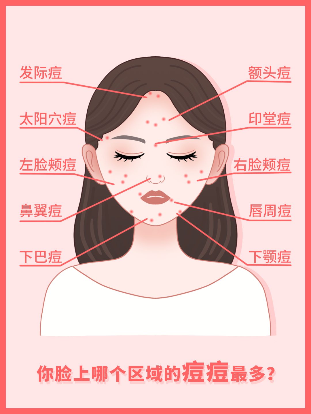 脸上频繁长痘的原因及治疗方法,左脸颊反复长痘原因及改善方法