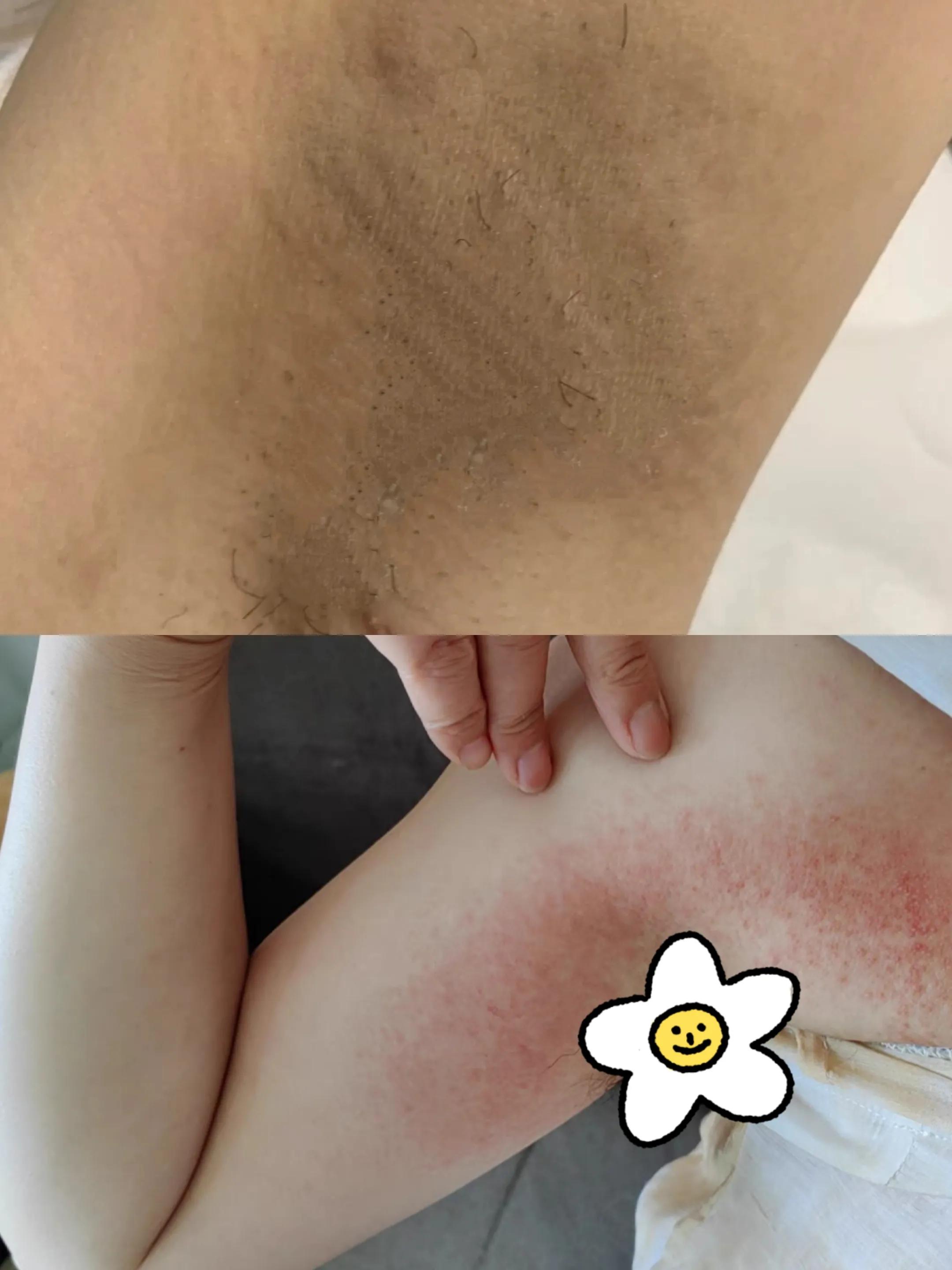 汗味大臭怎么选择止汗露,平价止汗露去臭测评