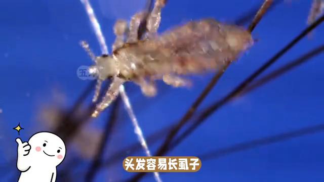 在头上好几年的虱子还能杀掉吗,头上的虱子为什么那么难去掉