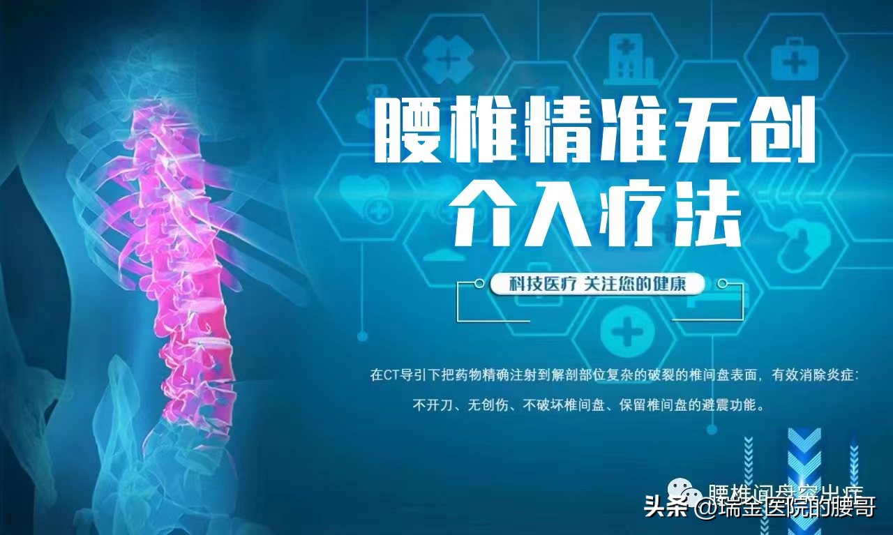 最新治疗腰突症方法,腰突症临床治疗预后