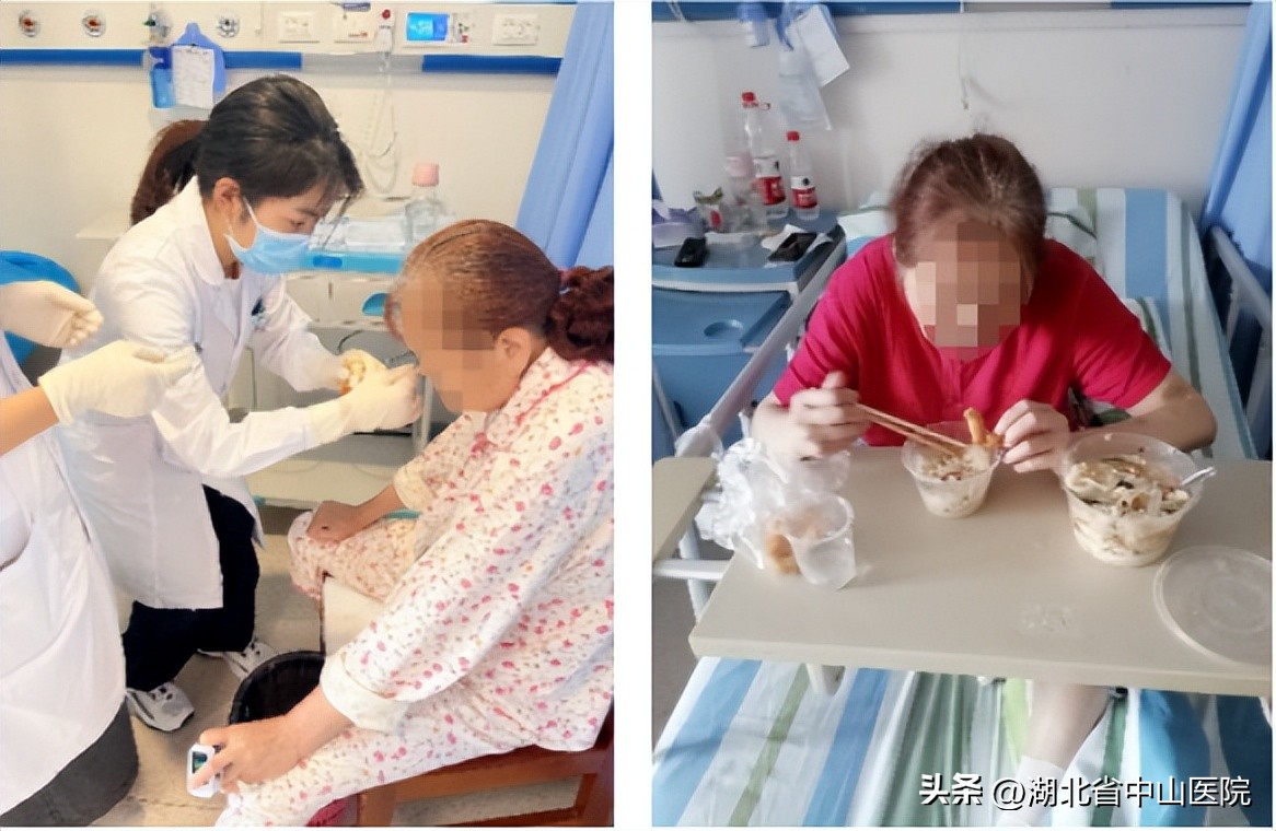 导管球囊扩张术治疗吞咽障碍操作,导管球囊扩张术治疗吞咽障碍