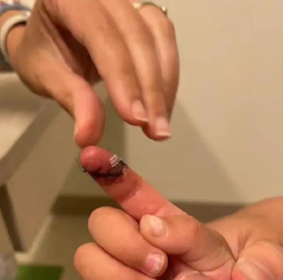 郑爽被曝剪手指、烟头烫孩子，这回彻底疯了？