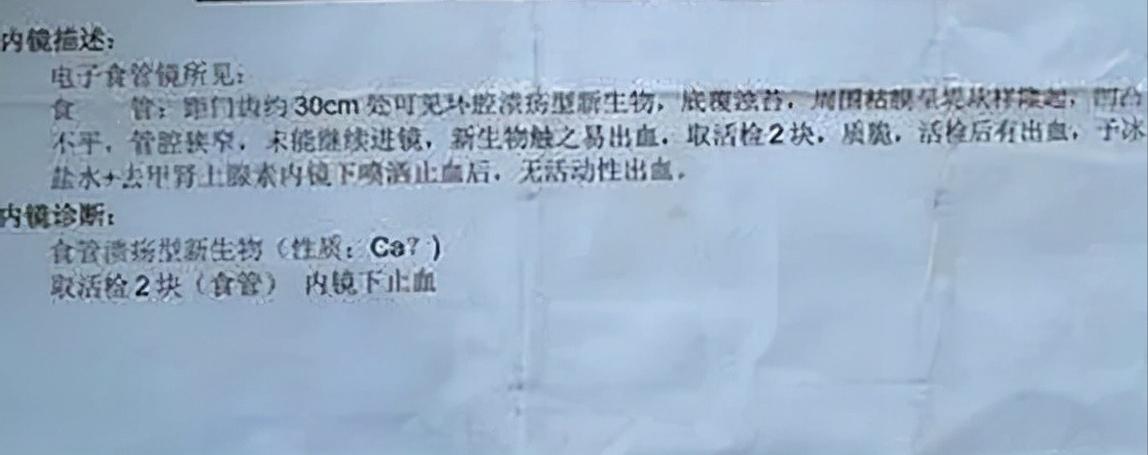 小腿巨粗的女孩,河南女子患病腿粗如大象