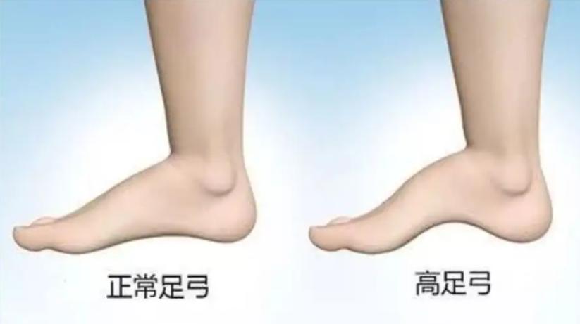 穿错鞋了怎么化解,穿错了鞋脚臭怎么办