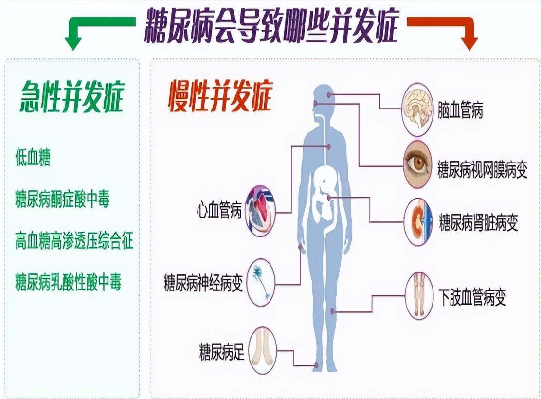 改善糖尿病微血管病变，减少尿蛋白保护肾功能，推荐3个中成药