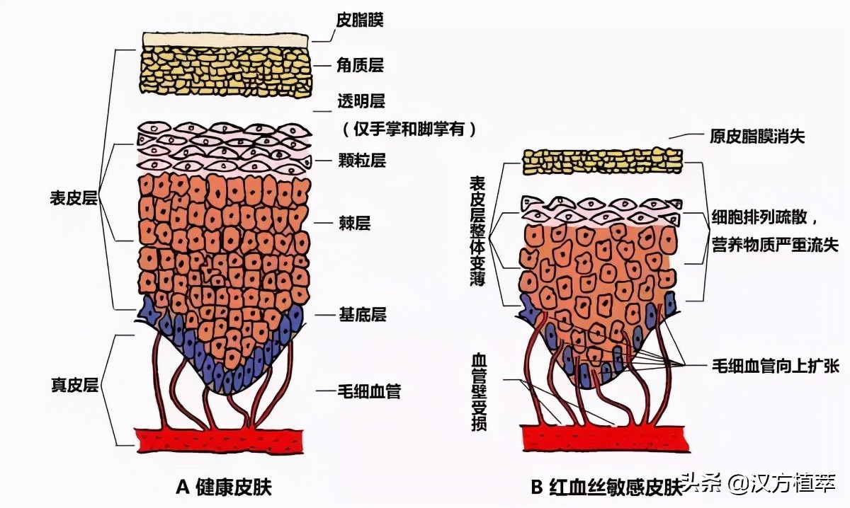 冬天来了皮肤红好痒,冬天来了脸上干燥